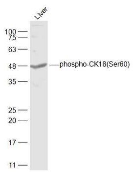Phospho-CK18 (Ser60) Rabbit Polyclonal Antibody