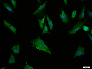 Phospho-CK18 (Ser60) Rabbit Polyclonal Antibody