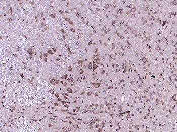 CNR2 Rabbit Polyclonal Antibody