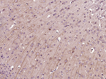 Phospho-Cofilin (Tyr140) Rabbit Polyclonal Antibody