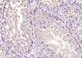 Phospho-CREM (Ser271 + Ser274) Rabbit Polyclonal Antibody