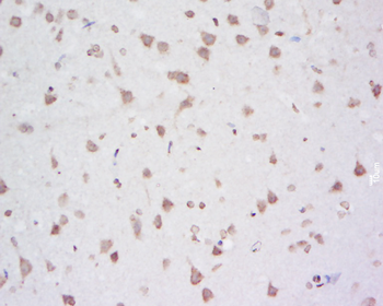 SMN1 Rabbit Polyclonal Antibody