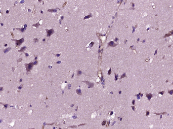 WISP2 Rabbit Polyclonal Antibody