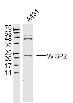 WISP2 Rabbit Polyclonal Antibody