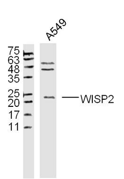 WISP2 Rabbit Polyclonal Antibody