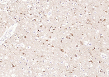 LC3A Mouse Monoclonal Antibody