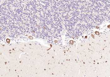 LC3A Mouse Monoclonal Antibody