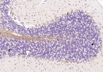 LC3A Mouse Monoclonal Antibody