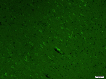 LC3A Mouse Monoclonal Antibody