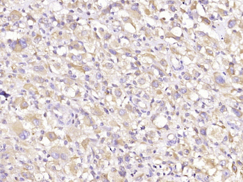 MEK2 Mouse Monoclonal Antibody