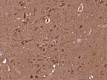 MEK2 Mouse Monoclonal Antibody