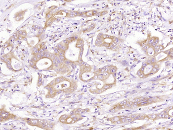 MEK2 Mouse Monoclonal Antibody