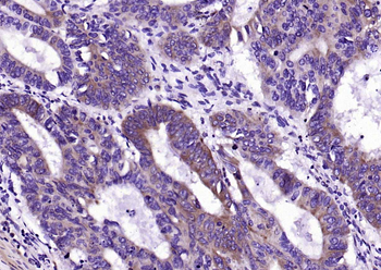 MEK2 Mouse Monoclonal Antibody