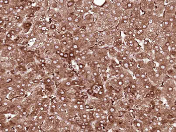 MEK2 Mouse Monoclonal Antibody