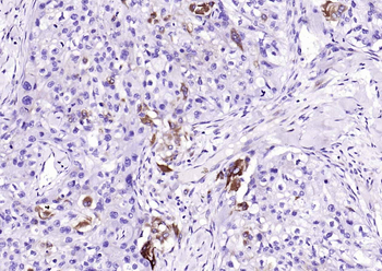 MEK2 Mouse Monoclonal Antibody