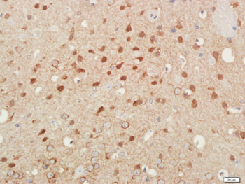 MEK2 Mouse Monoclonal Antibody