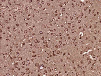 MEK2 Mouse Monoclonal Antibody