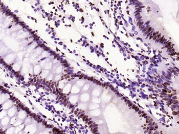 Histone H3 (di methyl K79) Mouse Monoclonal Antibody