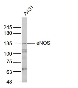 ENOS Rabbit Polyclonal Antibody