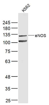 ENOS Rabbit Polyclonal Antibody