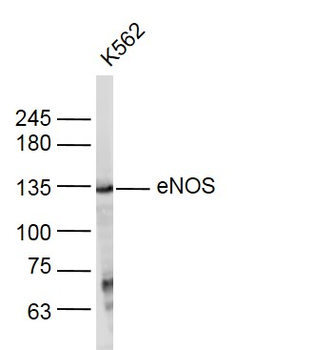 ENOS Rabbit Polyclonal Antibody