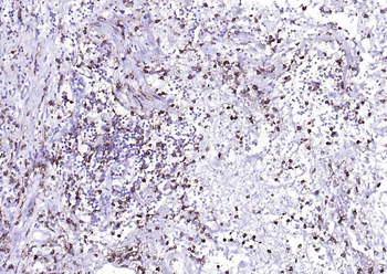 CD14 Rabbit Polyclonal Antibody