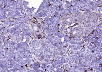 CD14 Rabbit Polyclonal Antibody