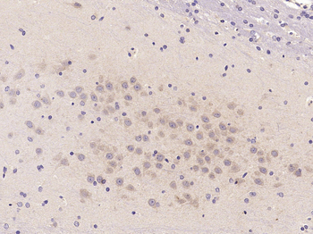 Beta IV Tubulin Rabbit Polyclonal Antibody