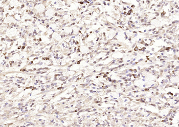 VEGF-C Rabbit Polyclonal Antibody