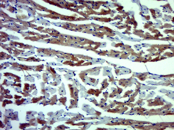 HSP27 Rabbit Polyclonal Antibody