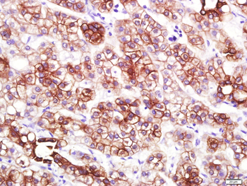 CK18 Mouse Monoclonal Antibody