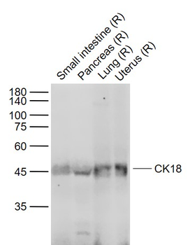CK18 Mouse Monoclonal Antibody