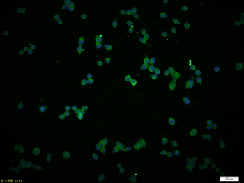 IL-4R Rabbit Polyclonal Antibody