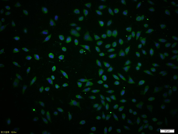 IL-4R Rabbit Polyclonal Antibody