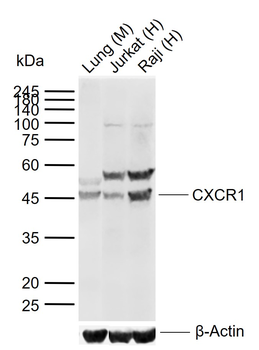 CXCR1 Rabbit Polyclonal Antibody