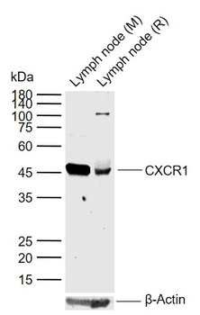 CXCR1 Rabbit Polyclonal Antibody