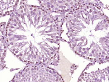 HOXA10 Rabbit Polyclonal Antibody