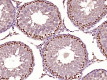 HOXA10 Rabbit Polyclonal Antibody