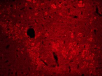 ABCG2 Rabbit Polyclonal Antibody