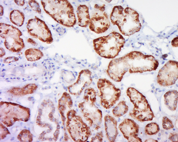 SLC34A1 Rabbit Polyclonal Antibody