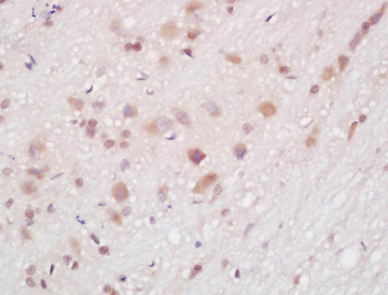 CYP3A4 Rabbit Polyclonal Antibody