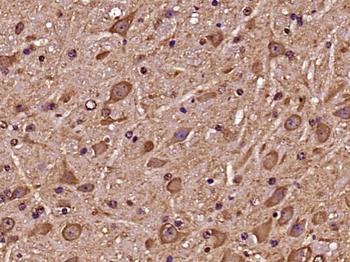 COX10 Rabbit Polyclonal Antibody