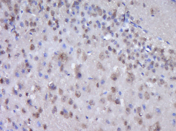 CNOT6 Rabbit Polyclonal Antibody