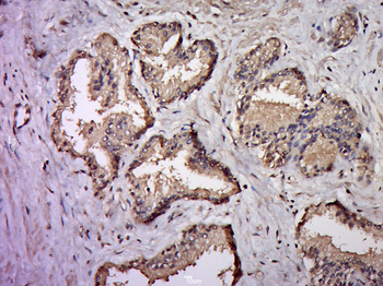 CCL27 Rabbit Polyclonal Antibody
