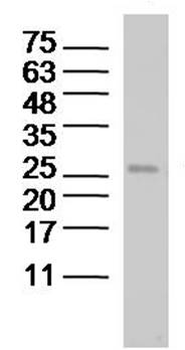 Bcl-2 Mouse Monoclonal Antibody