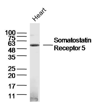 Somatostatin Receptor 5 Rabbit Polyclonal Antibody