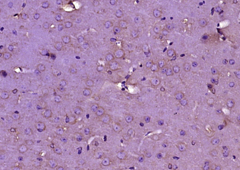 CD9 Rabbit Polyclonal Antibody