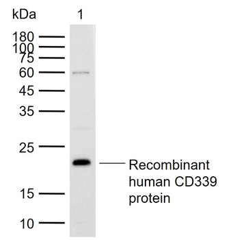 Jagged1/CD339 Rabbit Polyclonal Antibody