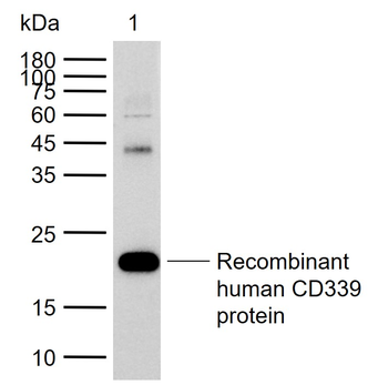Jagged1/CD339 Rabbit Polyclonal Antibody
