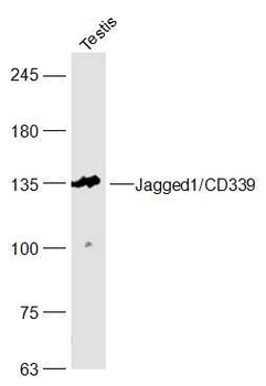 Jagged1/CD339 Rabbit Polyclonal Antibody
